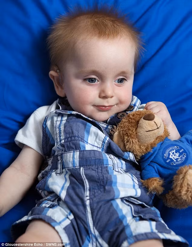 Nếu không được xử lý, bệnh vàng da có thể tiến triển xấu thành vàng da nhân não, ảnh hưởng đến não, dây thần kinh cột sống và có thể đe dọa tính mạng của trẻ. Trường hợp của bé Brian là lời cảnh tỉnh đối với các bậc cha mẹ không nên lơ là với bệnh vàng da hoàn toàn có thể xử lý được để tránh những hậu quả dị tật cả đời với con mình. 