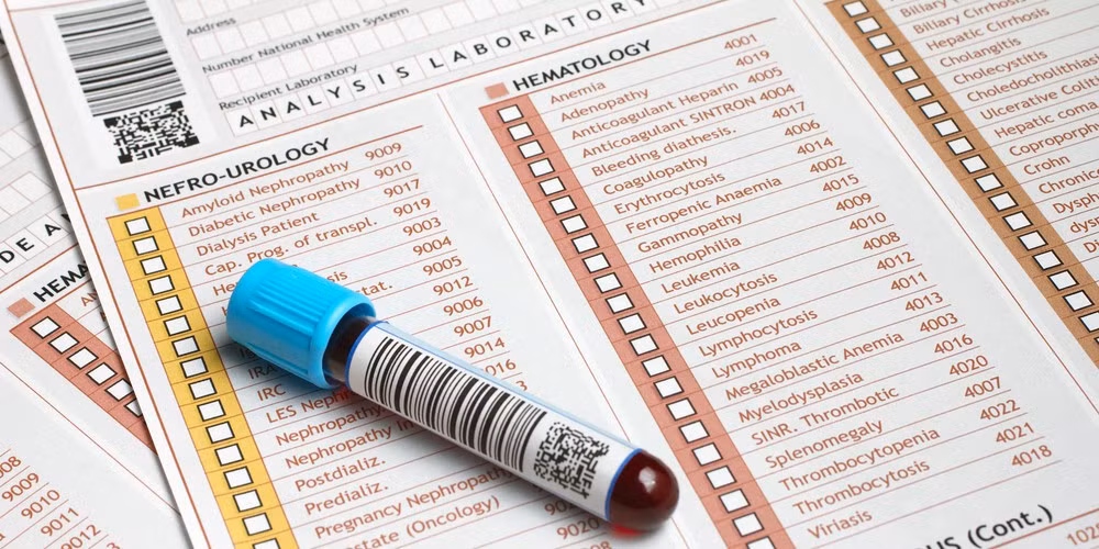 Xét nghiệm canxi khi bị sỏi thận: Không cần phải xét nghiệm canxi lần thứ hai trong vòng 3 tháng sau khi được xác định bị sỏi thận, bệnh ở xương hoặc bệnh do rối loạn thần kinh. 