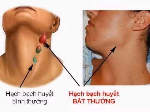 Đối với những người từ bỏ thuốc lá thì sau 5 năm những biến đổi ADN này sẽ quay trở lại như bình thường. Chỉ có điều 19 gien đã bị biến đổi, trong đó có gien TIAM2 gây ung thư bạch huyết giữ nguyên trạng thái như vậy trong suốt 30 năm. 