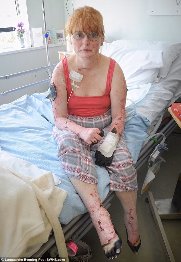 Bác sĩ cho biết với tình trạng hiện nay, cần phải cắt bỏ cả hai chân, tay trái và 3 ngón tay phải vì cô đang mất máu nghiêm trọng. Đây thực sự là một tin sốc với cô và các con nhưng cô cảm thấy mình vẫn may mắn vì giữ được tính mạng. Còn các con của cô Charly thì cho rằng dù sao có một người mẹ tàn tật vẫn còn tốt hơn là mất mẹ. 