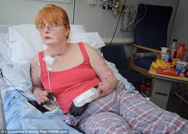 Nhiễm độc máu liên cầu là bệnh có thể gây chết người do một viêm nhiễm hoặc một vết thương nào đó, triệu chứng thường là sốt cao hoặc giảm nhiệt độ, toàn thân ớn lạnh, tim đập nhanh. Những người có hệ miễn dịch yếu là những người dễ mắc khuẩn liên cầu nhất. 