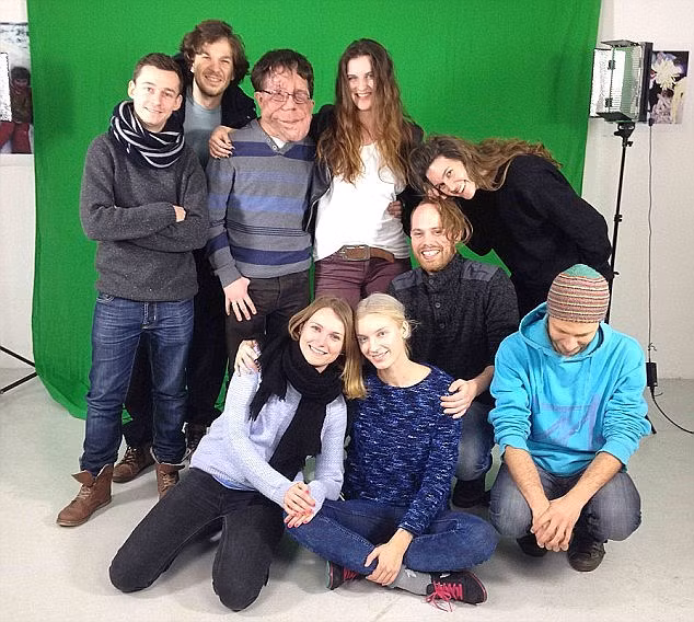 Vẻ ngoài của Adam khiến anh bị đặt biệt danh “thằng gù nhà thờ Đức bà”, “người voi” hay “mặt sẹo” từ khi còn đi học. Anh tâm sự rằng những năm tháng đó không hề dễ dàng gì khi anh phải đối phó với quá nhiều thứ, từ việc học hành, tìm bạn chơi đến thay đổi hormone.