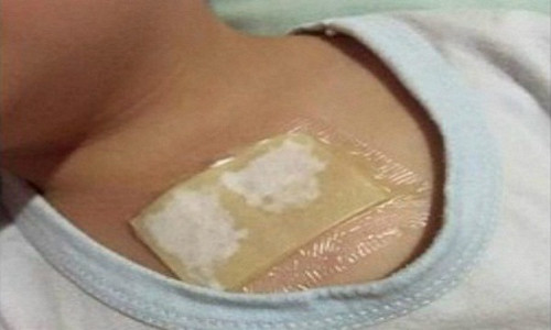 Phương pháp túi gừng đắp ngực này nên thực hiện trước khi đi ngủ và để qua đêm đối với người lớn. Tuy nhiên đối với trẻ em chỉ nên để từ 2-3 tiếng để tránh làm tổn thương làn da mỏng manh của bé. 