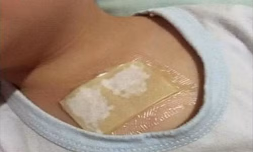 Phương pháp túi gừng đắp ngực này nên thực hiện trước khi đi ngủ và để qua đêm đối với người lớn. Tuy nhiên đối với trẻ em chỉ nên để từ 2-3 tiếng để tránh làm tổn thương làn da mỏng manh của bé. 