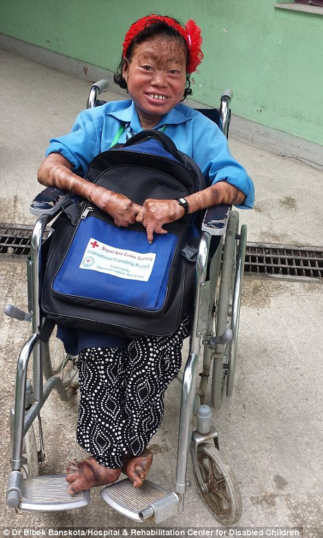 May mắn hơn nữa là một tổ chức tình nguyện quốc tế đã biết đến câu chuyện này và tặng vaseline cho Nagina để cô bé có thể dùng cả đời. Cô bé hiện đang học nội trú tại một trường khuyết tật do bệnh viện tài trợ. Mặc dù một trong hai tay bị biến dạng nhưng Nagina viết chữ khá đẹp và được đánh giá là một học sinh sáng lạn.