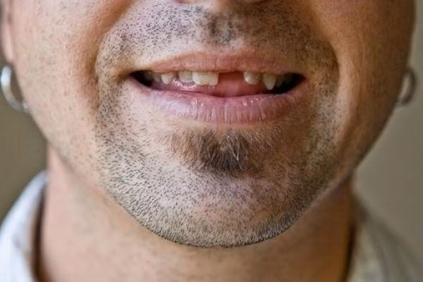 Các triệu chứng khác cần để ý là môi sưng u hoặc dày lên, chảy máu bất thường hoặc tê miệng, rụng răng không rõ nguyên nhân, khó cử động xương hàm. (Ảnh: Dental Associates)