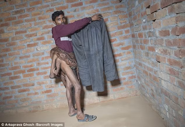 Vì vậy nên cần tiến hành một loạt các xét nghiệm tiếp theo xem Arun có thể có thận thừa, ống tiểu thừa hay bàng quang thừa hay không rồi mới xác định khả năng phẫu thuật