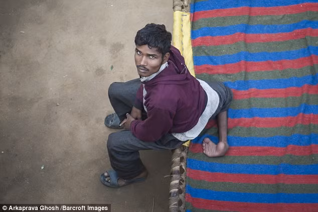 Một thanh niên trẻ tuổi sinh ra đã có 4 chân đã dùng các phương tiện thông tin đại chúng để kêu gọi các bác sĩ phẫu thuật cắt bỏ bớt đi 2 chân của mình. 