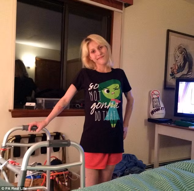 Gia đình và bác sĩ không còn cách nào khác là phải cắt bỏ đi phần chân dưới của cô trong lúc cô vẫn đang hôn mê. Đương nhiên khi tỉnh dậy và thấy bị cưa chân, Daniel đã hét lên đầy hoảng sợ. Tiền sử Ivy Daniels bị hội chứng Beckwith-Wiedemann tức phát triển quá mức khiến chân trái dài hơn chân phải và đi khập khiễng. 