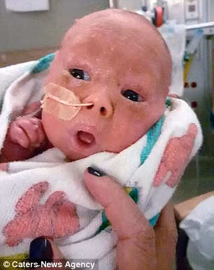 Hàng ngày bé được cho ăn bằng ống thông rồi vị viêm da. Xung quanh thường xuyên có một đội ngũ gồm bác sĩ dinh dưỡng, bác sĩ khoa mắt, khoa tai và họng. 