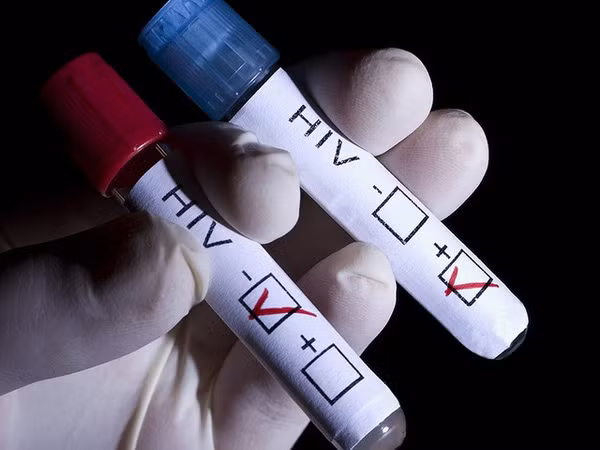 Virus HIV lây lan qua đường tình dục hoặc lây từ mẹ sang con. Virus này khiến hệ miễn dịch suy yếu làm tăng nguy cơ mắc các bệnh ung thư do virus khác như ung thư bạch huyết, ung thư hậu môn và các cơ quan sinh dục, ung thư gan, ung thư mắt, ung thư da… và có thể cả ung thư phổi. 