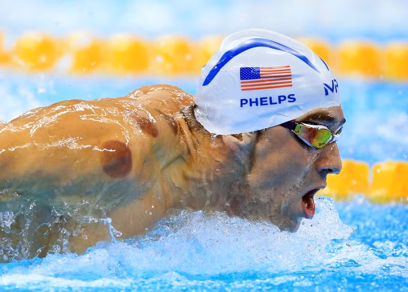 Tại đại hội thể thao Olympic 2016, khi vận động viên bơi lội nổi tiếng giới Michael Phelps xuống nước để thực hiện bài thi bơi, nhiều người chú ý đã chú ý đến những vệt tròn màu tím trên vai kình ngư này. Những vòng tròn màu đỏ đó do giác hơi, một phương pháp tuy không còn xa lạ ở Việt Nam nhưng gần đây được nhiều vận động viên nổi tiếng thế giới thực hiện để hồi phục nhanh hơn và thi đấu tốt hơn. 
