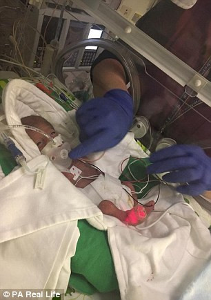 Marissa được tiêm hai mũi steroid để trưởng thành phổi cho thai nhi và được cho về nhà trong 2 tuần để thuốc phát huy tác dụng. Không may khi tái khám 2 tuần sau, Rayden vẫn không nhận đủ oxy và dưỡng chất qua nhau thai. 