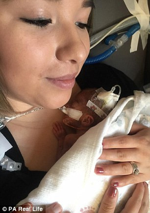 Rayden Isavic Mondragen chỉ dài 26,7cm và nặng 400g, nhỏ hơn cả một chiếc giỏ đựng hoa quả khi chào đời vào tháng 9 vừa rồi. 