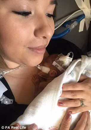 Rayden Isavic Mondragen chỉ dài 26,7cm và nặng 400g, nhỏ hơn cả một chiếc giỏ đựng hoa quả khi chào đời vào tháng 9 vừa rồi. 