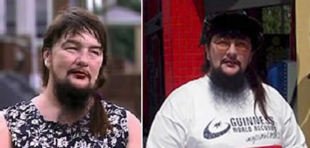 Với bộ râu dài 27,9cm, cô Vivian Wheeler được tặng danh hiệu người phụ nữ có bộ râu dài nhất. Được biết cô bắt đầu cạo râu từ năm 7 tuổi nhưng đến năm 1993 thì ngừng để râu mọc tự nhiên. 