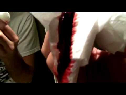 Cần đưa trẻ đến bệnh viện ngay trong những trường hợp sau: Tình trạng chảy máu kéo dài quá 5 phút mặc dù đã ấn giữ vết thương; vết thương chưa được làm sạch đúng cách hoặc vết thương quá bẩn; trẻ có dấu hiệu bị sốc, vết thương trên cổ hoặc trên mặt trẻ; vết thương do bỏng điện, do người hoặc động vật cắn, do bỏng; vết thương bị dính với vật gây vết thương không lấy ra được; vết thương sâu rộng, trông như cần phải khâu; trẻ chưa tiêm phòng uốn ván hoặc đã tiêm phòng uốn ván hơn 10 năm. 