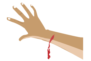 Nguyên tắc cần nhớ khi sơ cứu chảy máu ồ ạt là cần hành động nhanh để tránh mất máu và sốc. 