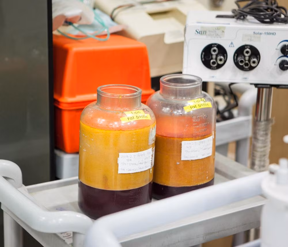 Ảnh chụp hai chiếc lọ hút mỡ bên trong phòng nhân viên.