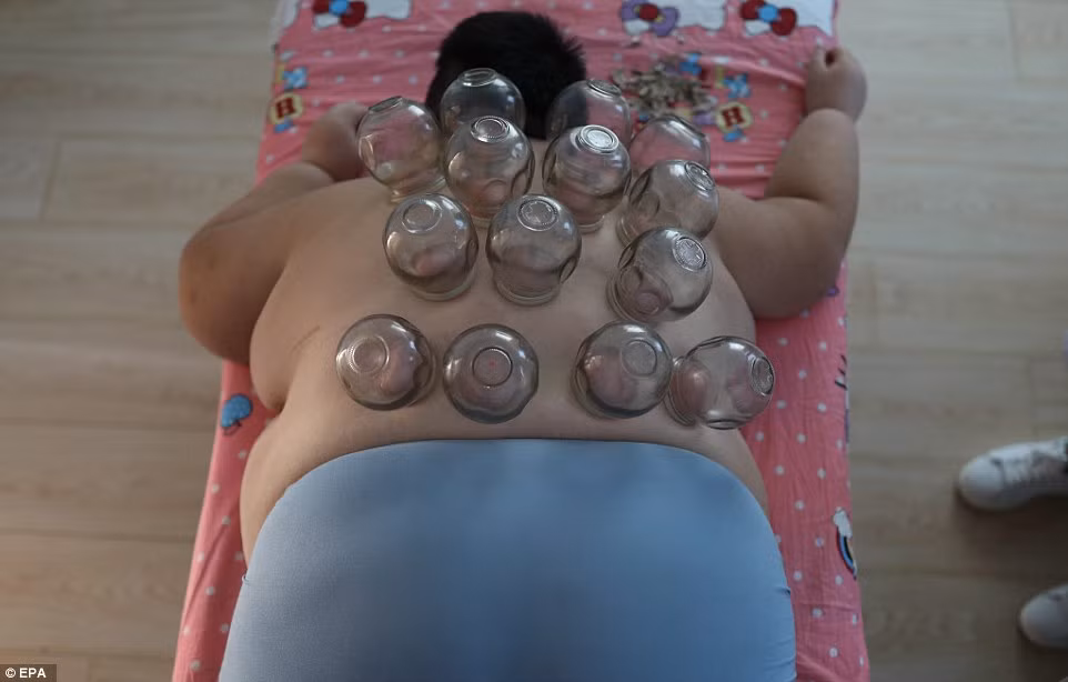 Được chẩn đoán bệnh từ năm 3 tuổi nhưng đến 4 tuổi thì cậu bé đã bị béo phì và nặng 35kg, gấp 2,5 lần những bé cùng tuổi. Chỉ sau đó vài năm, cân nặng của Li Hang tăng lên chóng mặt khiến cậu bé học hành rất khó khăn. Cậu bé được chẩn đoán mắc 10 bệnh liên quan đến béo phì, trong đó có huyết áp cao, gan nhiễm mỡ và gút. 