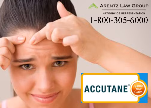 Một vài bệnh nhân nhận thấy da họ thậm chí còn tồi tệ hơn khi bắt đầu sử dụng thuốc. Nhưng bạn cần chấp nhận sự thật rằng da bạn sẽ xấu đi rất nhiều trong thời gian này rồi mới đẹp lên được. 