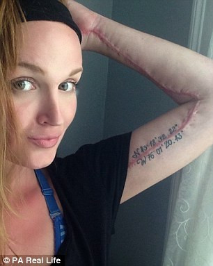 Trường hợp của cô được xác định là viêm cân mạc hoại tử do vi khuẩn streptococcus nhóm A tấn công sâu bên dưới lớp da. Vi khuẩn này thường có trong cổ họng hoặc trên bề mặt da và thông thường chỉ ảnh hưởng nhẹ như gây sốt hoặc viêm họng. Trường hợp của Erin là trường hợp hiếm gặp khi vi khuẩn ăn sâu vào cơ và máu nếu không đề phòng xử lý kịp thời sẽ dẫn đến tử vong. 