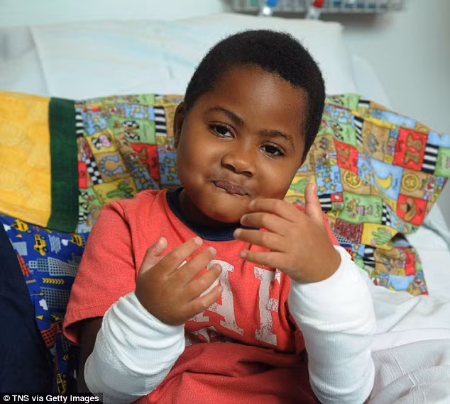 Vào năm 2015, tức 7 năm sau, cậu bé đã được phẫu thuật ghép tay. Ca phẫu thuật kéo dài hơn 10 giờ đã thành công và Zion trở thành bệnh nhân ghép tay nhỏ tuổi nhất của Mỹ. Bác sĩ Scott Levin trưởng ca phẫu thuật cho biết chưa bao giờ nhìn thấy cậu bé khóc vì đau mà luôn rất can đảm, thậm chí còn dũng cảm hơn cả người lớn. 