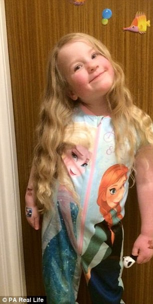 Sợ ảnh hưởng tới sức khỏe và cả tính mạng, không ai dám để bé Molly một mình vì cô bé sẽ nghĩ ra mọi cách để ăn. 