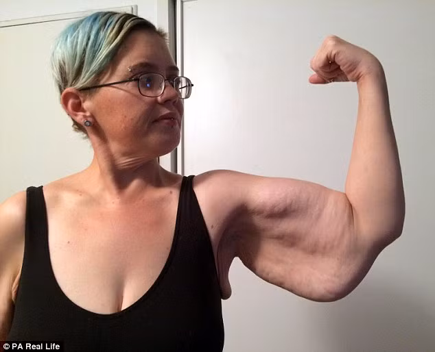 Để sinh con, cô buộc giảm cân bằng phẫu thuật băng dạ dày. Chỉ trong vòng 1 tuần sau khi phẫu thuật, cô đã giảm được hơn 5kg và sau một tháng đã giảm được 20kg. 