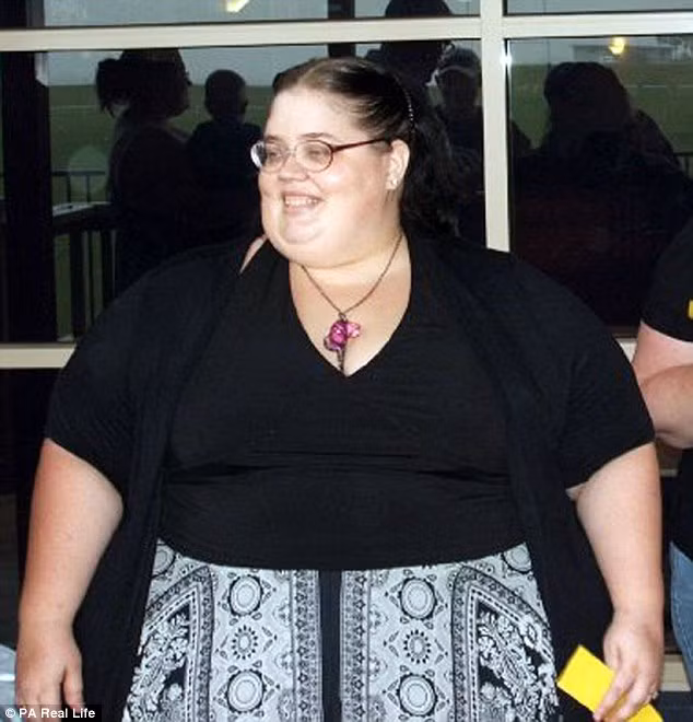 Phần da chảy xệ nhiều nhất là cánh tay, đùi và bụng, thậm chí phần da thừa còn kẹt cả vào cửa xe ô tô. Cô xấu hổ và tự ti đến mức không còn dám thay quần áo trước mặc bạn trai nữa. 