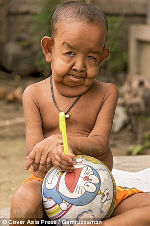 Mẹ của Bayezid năm nay mới 18 tuổi rất ngạc nhiên vì sự thông minh của con trai mình mặc dù có hình dạng không bình thường. Cô cho biết khi sinh ra, bé Bayezid chỉ có da bọc xương và trông như người ngoài hành tinh, 3 tuổi mới biết đi nhưng 3 tháng đã mọc đầy đủ răng lợi. 