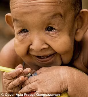 Được cho là mắc bệnh lão hóa sớm, em bé trong hình hài của ông lão 80 tuổi này luôn khiến những người dân nơi đây tránh xa và trẻ em thì sợ hãi không dám chơi cùng mặc dù bé thông minh hơn những đứa trẻ cùng tuổi. 