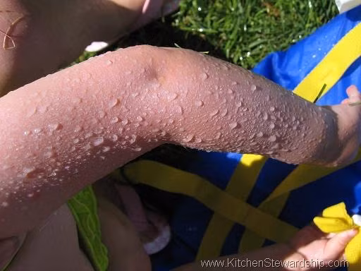 Vậy làm cách nào để tìm được kem chống nắng phù hợp nhất với bạn. Cũng theo gợi ý của các chuyên gia da liễu, hãy tìm kem chống nắng có ghi “phổ rộng”, có nghĩa là bảo vệ da khỏi cả tia UVA và UVB. Tia UVA làm da lão hóa sớm khiến da bị nhăn và có đốm nâu, còn tia UVB thì làm da bỏng rát, và cả hai tia này đều dẫn đến ung thư da. 