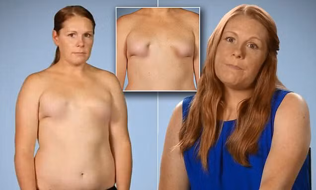 Quý bà này cho rằng phẫu thuật nâng ngực là quyết định đáng tiếc nhất dù mục đích không phải là có một bộ ngực to mà chỉ cần một bộ ngực bình thường. 