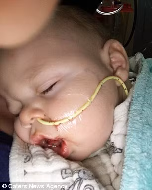 Bé được xác định mắc hội chứng Beckwith-Wiedemann, tức rối loạn phát triển quá mức ảnh hưởng đến các cơ quan chức năng của em bé như lưỡi, thận và gan. Trên thế giới có khoảng 15.000 trường hợp mắc bệnh này. 90% các bé mắc bệnh có lưỡi phát triển quá khổ và gặp rắc rối từ bình thường đến nghiêm trọng với khả năng ăn uống, thở và nói. 