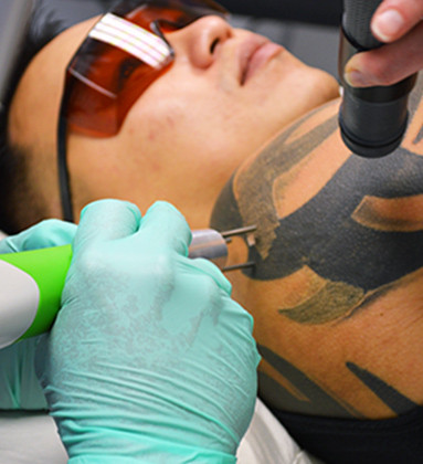 Nếu xăm đè lên nốt ruồi hoặc vết bớt thì cần chừa ra một khoảng để quan sát những thay đổi trên da về sau nếu có. 