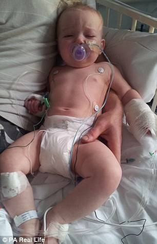 Em bé này bị bệnh động kinh trẻ em, một dạng bệnh cực kỳ hiếm gặp ở trẻ em khiến cô bé lên cơn động kinh nặng nhưng lại không đáp ứng với các loại thuốc điều trị hiện có. Tình trạng lên cơn gần như kéo dài liên tục trong ngày khiến hai vợ chồng phải thường xuyên túc trực bên cạnh con mình. 