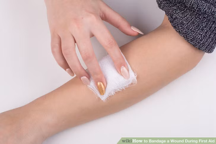 Nếu không may bị đứt tay chảy máu và không có đồ sơ cứu, một miếng băng vệ sinh có tác dụng không kém một dụng cụ băng vết thương vô trùng. Lấy một miếng băng vệ sinh ấn nhẹ vào vùng da bị rách để cầm máu cho đến khi bạn tìm được bông băng và thuốc. 