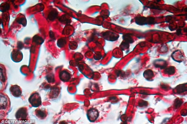 Canh bao ve chung nam men khang thuoc co the gay chet nguoi