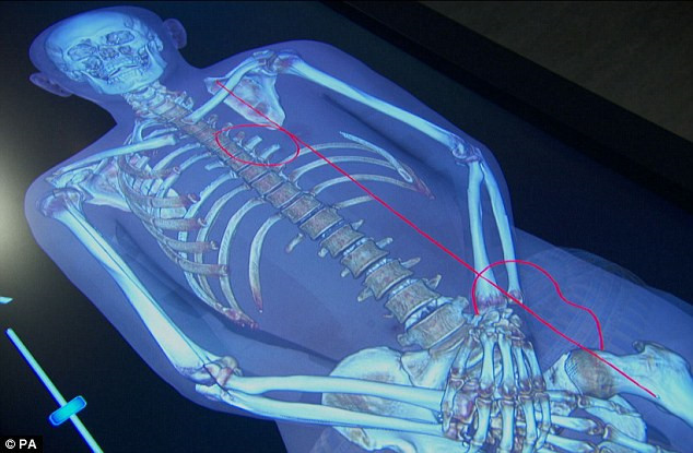 Theo thời gian, oxy phản ứng với dầu dùng để ướp xác gây ra vụ cháy khiến xác ướp vua Tutankhamun bắt lửa ngay sau khi đưa vào quách. Hậu quả là trái tim và xương ức của xác ướp bị thiêu rụi. Đồng thời, vài xương sườn của nhà vua quá cố bị gãy.