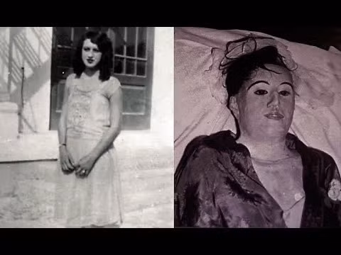 Khi thi hài Mesa có dấu hiệu phân hủy, Tanzler đã sử dụng các cách khác nhau để bảo quản. Rùng rợn hơn, Tanzler còn đặt xác chết lên giường ngủ của ông. Cứ như vây, Tanzler chung sống với thi hài Mesa trong gần 7 năm trước khi sự thật bị phát giác.