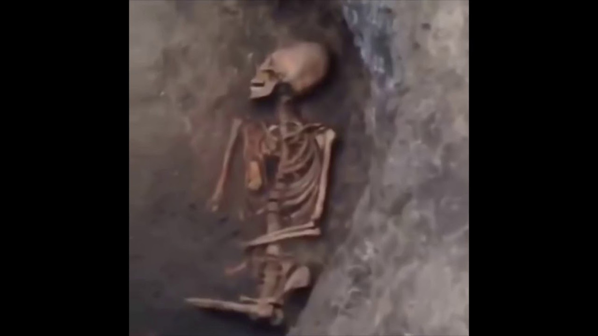 Tập tục làm biến dạng hộp sọ được một số nền văn minh cổ xưa ở châu Á, châu Âu thực hiện.