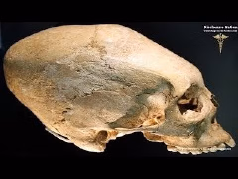 Do vậy, ngay từ khi còn nhỏ, những đứa trẻ được cha mẹ thực hiện tập tục kéo dài dạng hộp sọ vì khi ấy xương vẫn còn mềm.