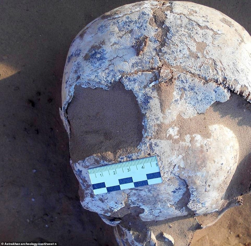 Mục đích của những ca phẫu thuật não thường là để giảm những cơn đau đầu dữ dội, loại bỏ máu tụ trong não do chấn thương gây nên hay điều trị chứng động kinh.