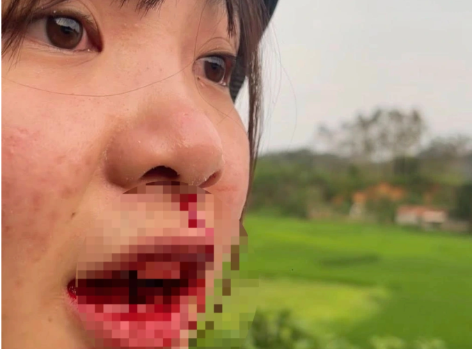 Xac minh tai xe o to hanh hung co gai chay mau o Bac Giang-Hinh-2