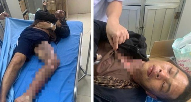 Trom day dien, hai nguoi o Bac Kan bi dien giat bong nang