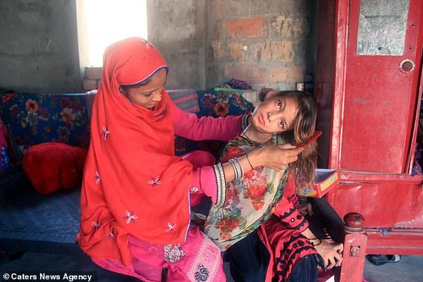 Be gai song voi chiec co veo 90 do vi nguyen nhan bat ngo-Hinh-4