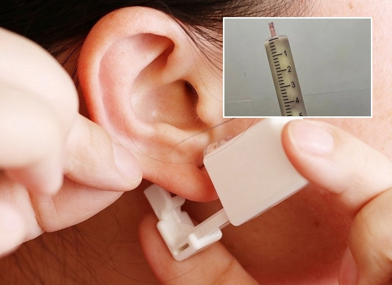 Tu bam lo tai, co gai gap hoa dang so