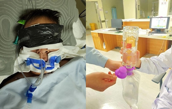 Ngo doc ruou gia, bac si cho uong ruou that lien khoi benh?