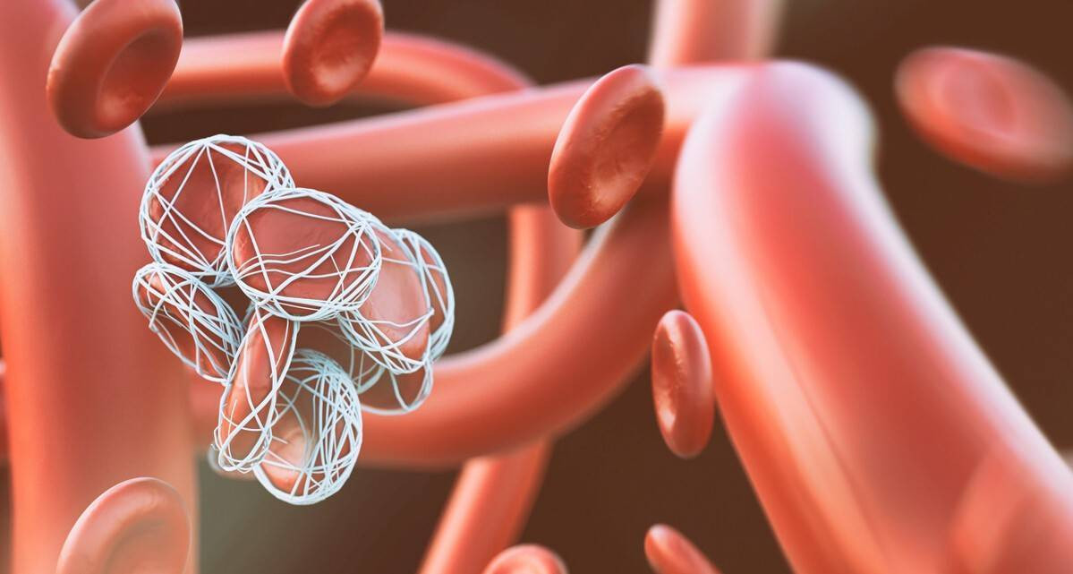 Nguoi bi benh nay khong nen tap the duc buoi sang keo dot tu-Hinh-2